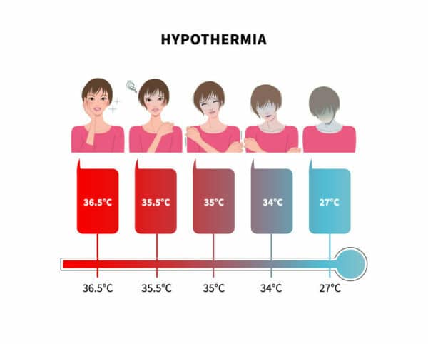 Shown are the body-temperature curve in the hypothermia (blue) and