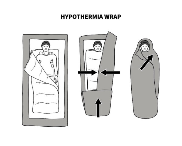 hypothermia body wrap